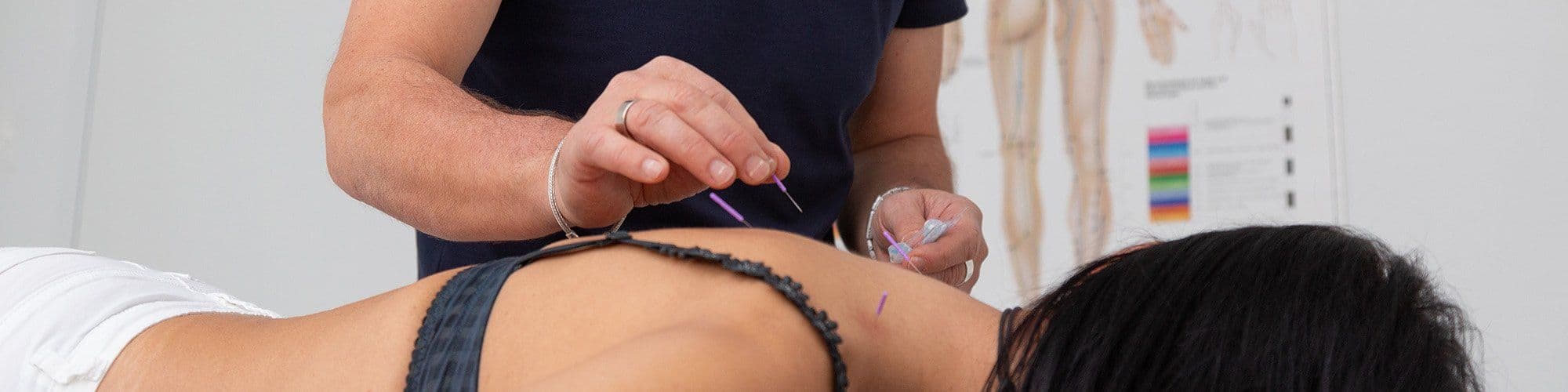 Akupunktur und Naturheilverfahren